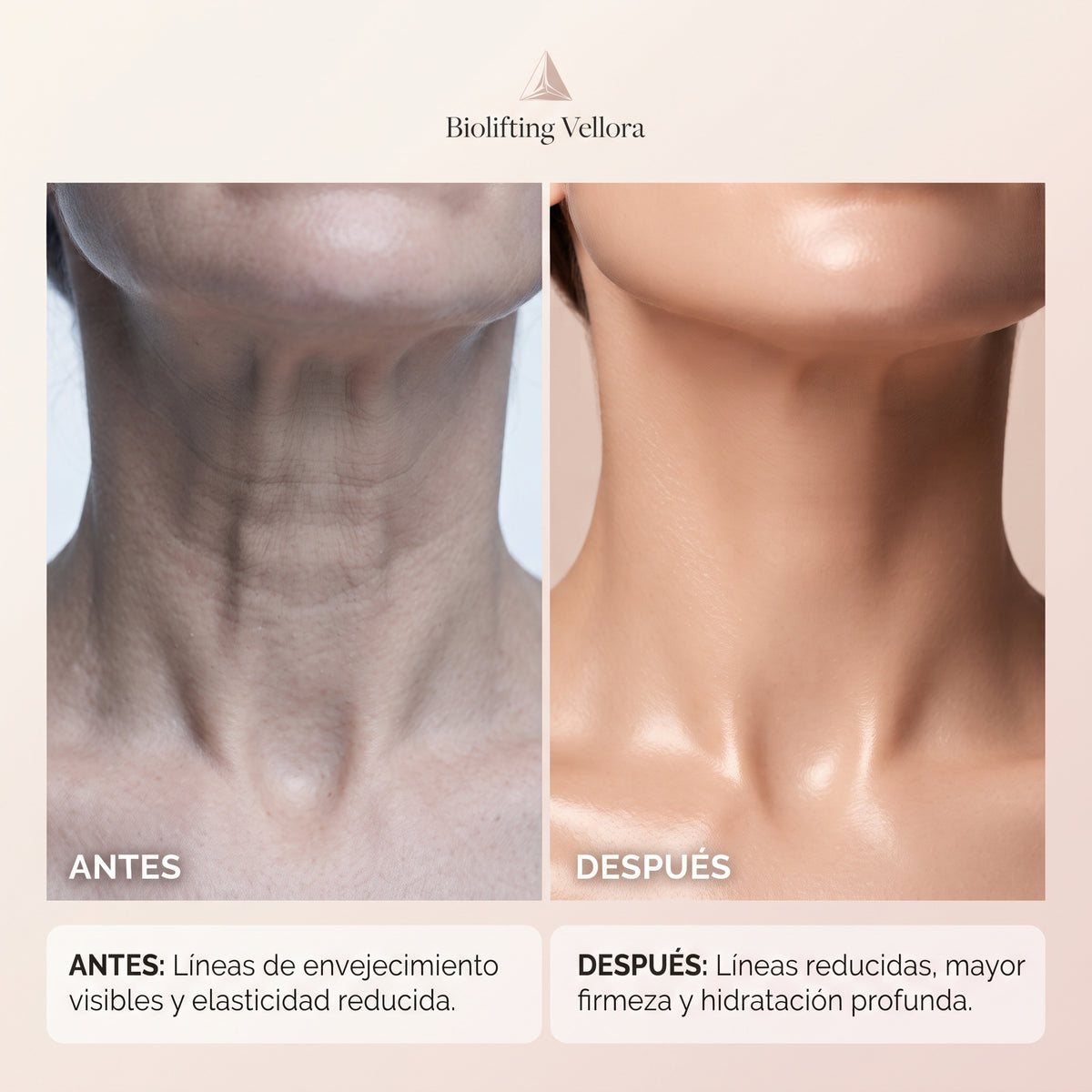 MASCARILLA BIO-LIFTING CUELLO | VELLORA CHILE